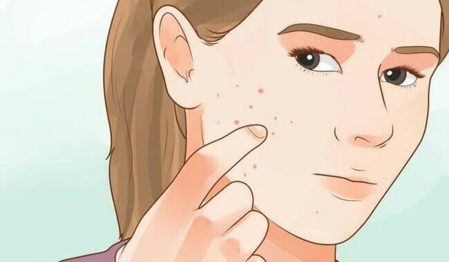 Si votre peau du visage est comme ceci, cela peut indiquer une perturbation hormonale