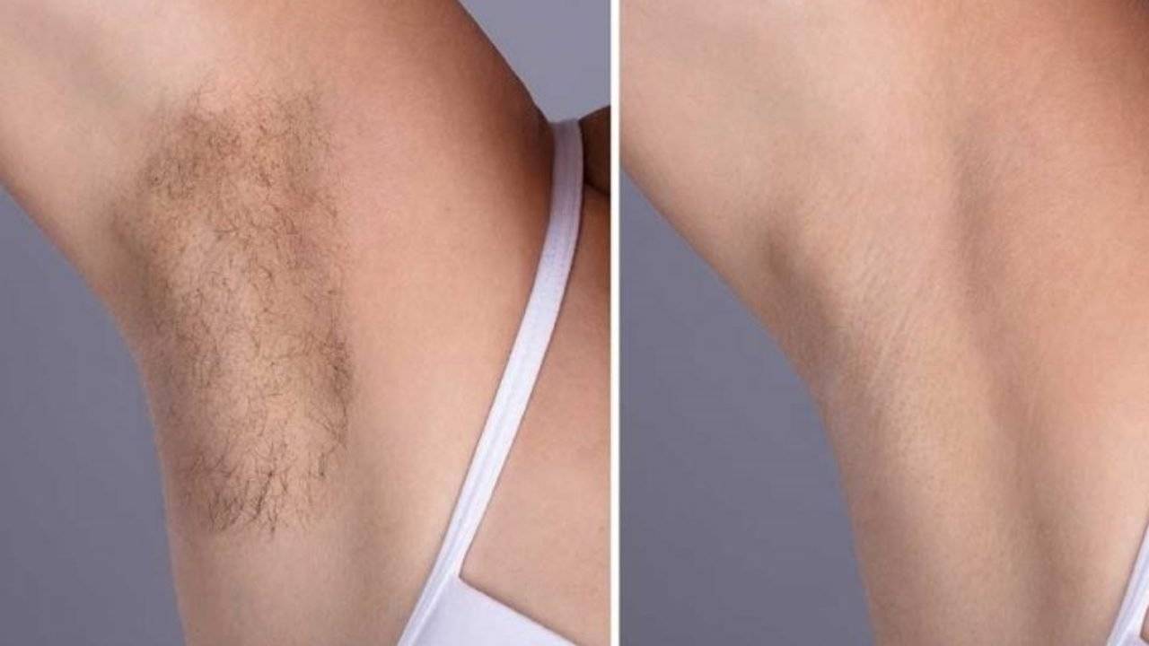 Un moyen facile d’enlever les poils sous le bras